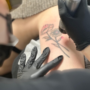 detatouage-laser-lagriffededaisy-02